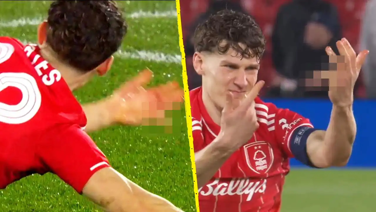 Ryan Yates gãy ngón tay nhưng vẫn thi đấu cho Nottingham Forest trước Fenerbahce Bong88VIP